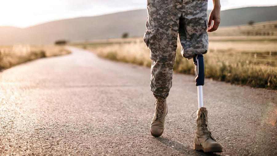 Компенсація витрат на протезування за кордоном